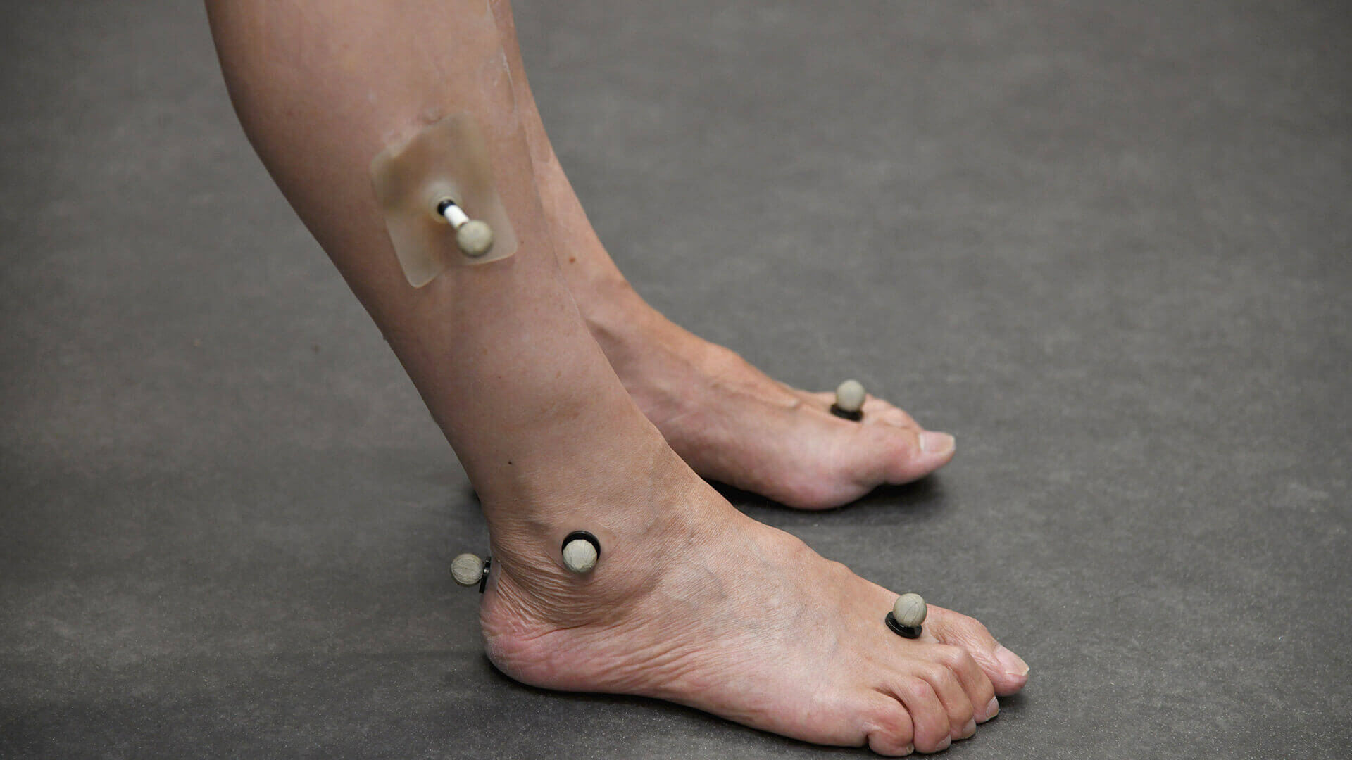 perna com sensores no laboratório de marcha